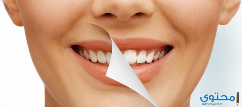 علاج اصفرار الاسنان6