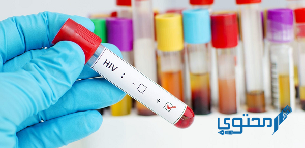 هل تحليل الدم الشامل يكشف الإيدز وماذا يظهر في تحليل الدم الشامل؟